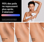 IPL Hair Removal Device